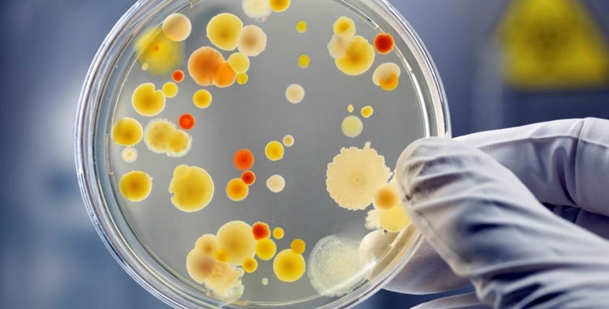 Главные причины кроются в бактериях, микробах и вирусах